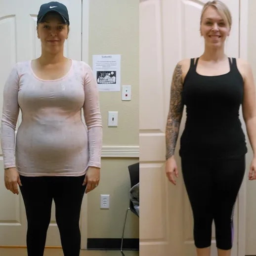 Before and after result