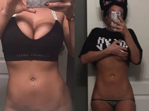 Before and after result
