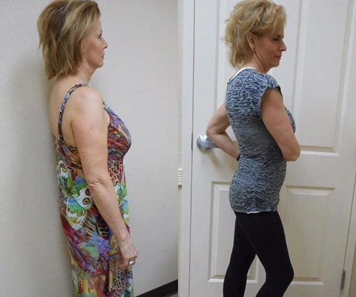Before and after result