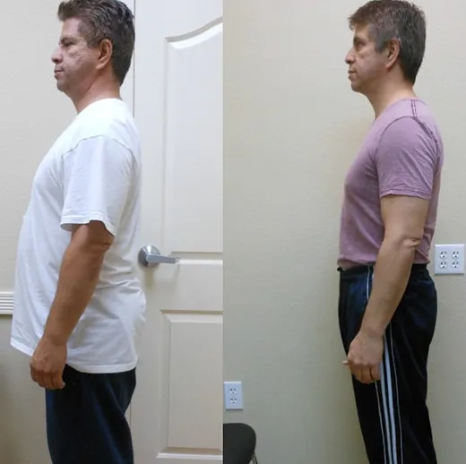 Before and after result