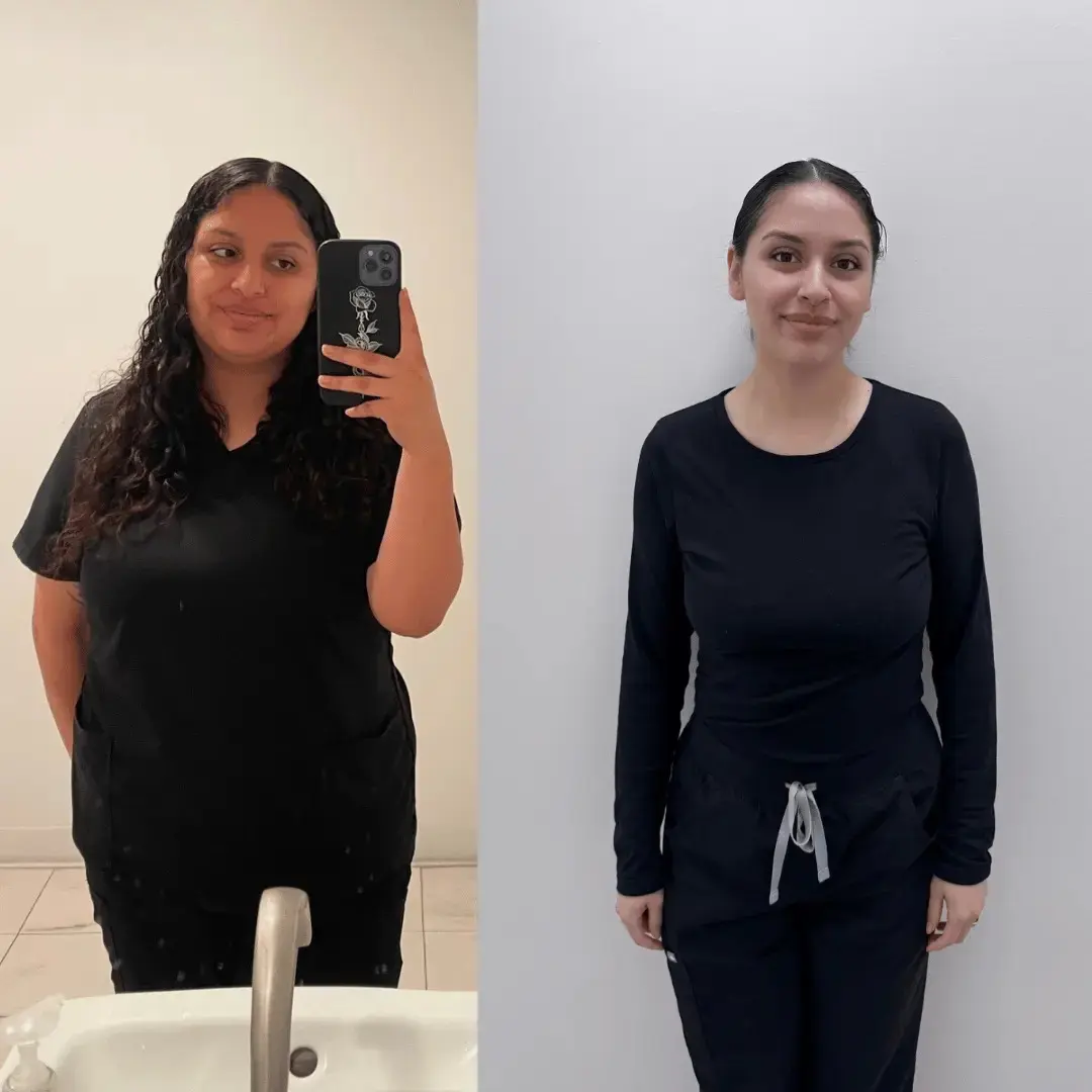 Before & after 1