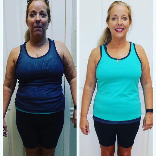 Before and after result