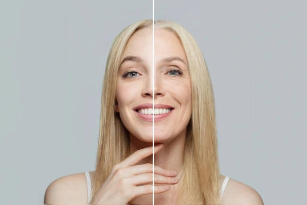 how to fix ozempic face naturally
