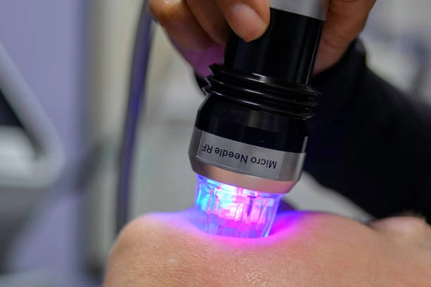 rf microneedling vs microneedling