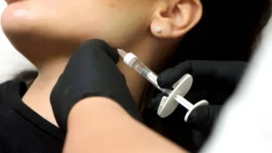 JUVÉDERM Fillers San Marcos