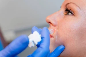 Juvederm Henderson