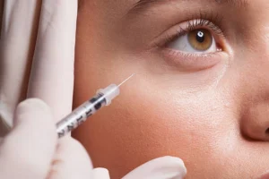 Under Eye Filler Henderson